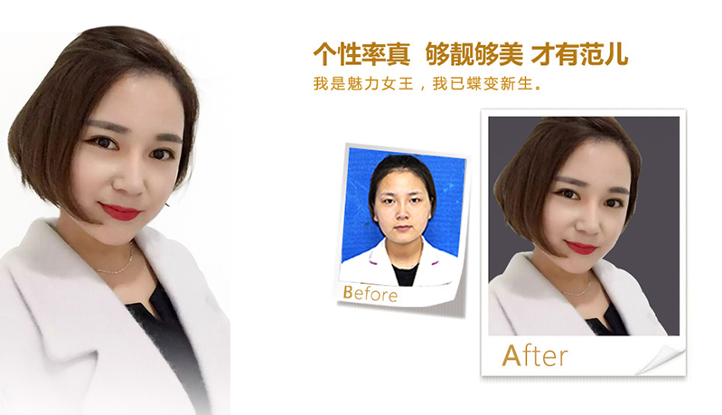 杭州美鼻、V脸